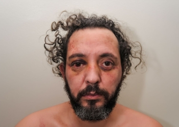 Ebrahim Buzhu, conocido como el 'carnicero de Ámsterdam Primer plano con el rostro visiblemente magullado, con hematomas alrededor de los ojos y expresión seria frente a un fondo neutro.